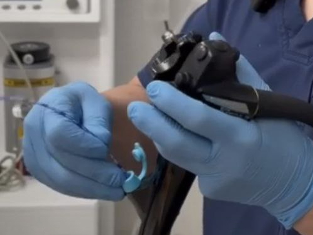 Превью видео: подготовка к колоноскопии